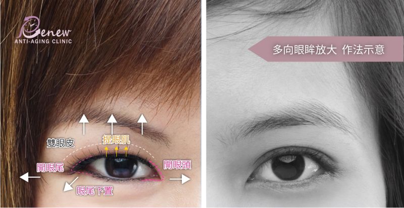 【开眼头&开眼尾】开眼头&开眼尾:电眼放「大」绝!混血美人就是你